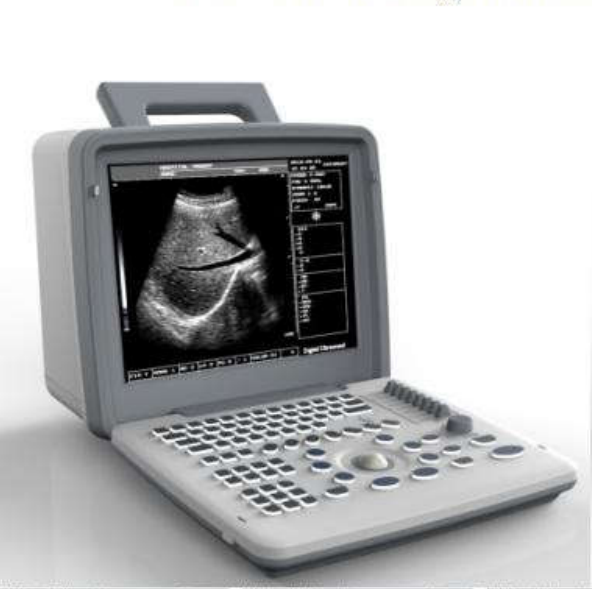 12 inch Digital Ultrasound Scanner.